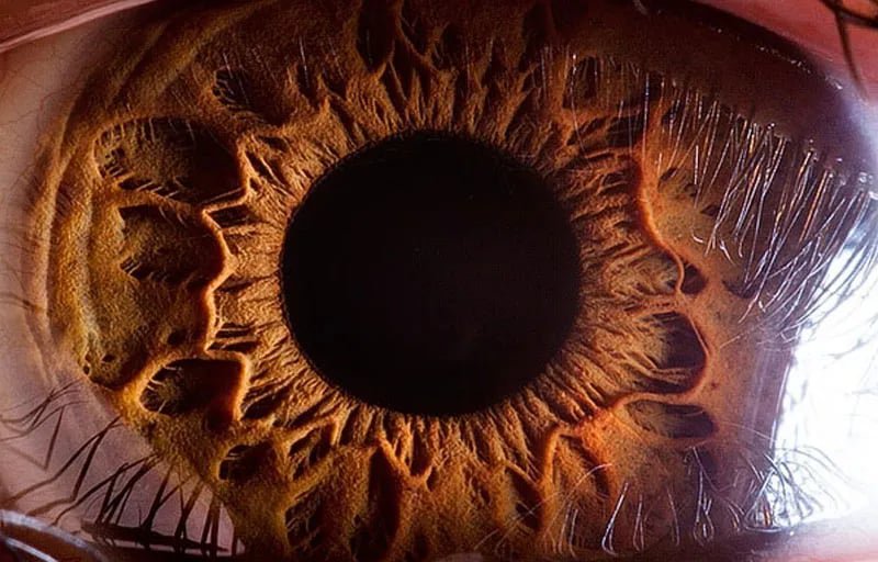 Human eye